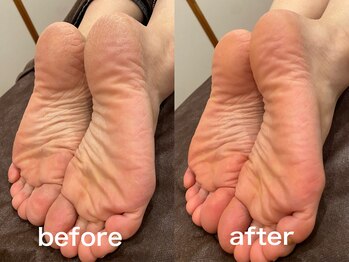 フワリ(Fuwari)/かかとケア