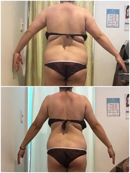 フォルティシモ ビューティ リラックス/小顔/エステ/背中/ダイエット