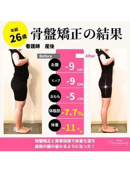 セレンディピティ 刈谷店(Serendipity)/【美容骨盤矯正】痩身ダイエット