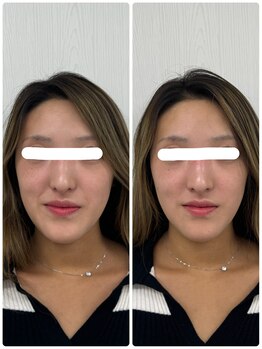 ラフテル鍼灸整骨院/桜川駅徒歩圏内で小顔矯正♪