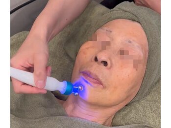 アシュレ リル 西多賀店(assure Lilou)/マイクロカレント&ラジオ波