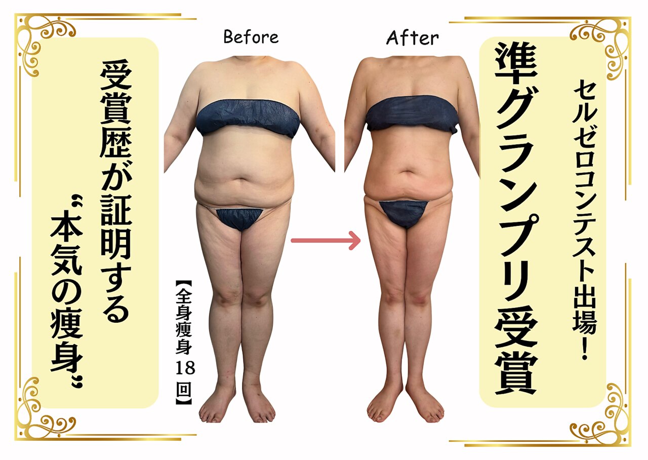 エミニー バイ エルズ(Eminy by L☆s)｜ホットペッパービューティー