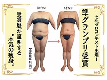 エミニー バイ エルズ(Eminy by L★s)