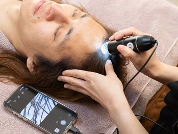 トータルメンズエステ キング(KING)/【頭皮】頭皮診断付ヘッドスパ