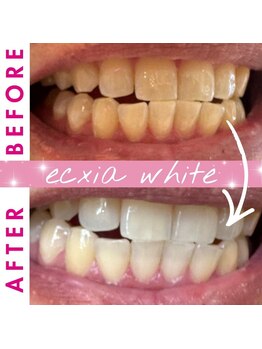 エクシアホワイト 倉吉店(ecxia white)/ビフォーアフター