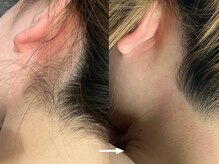 ヴィセラ(Vicella)/襟足スッキリ