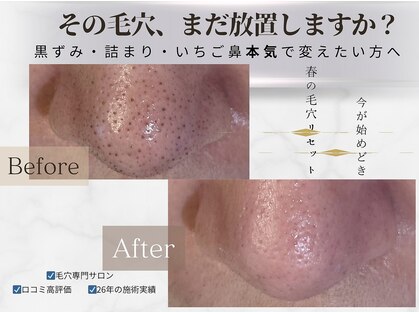 毛穴研究所の写真