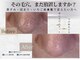 毛穴研究所の写真