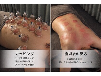癒(イヤシ)の写真