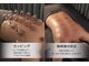癒(イヤシ)の写真