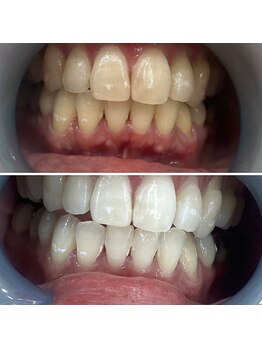 シャイニー 仙台駅東口(SHINY)/お客様の変化