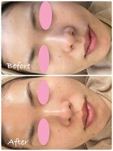 ロイ(Loy)/24/2/11のブログご覧ください♪