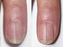 プラスミー(+me)/自爪育成