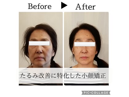 ミラクル(Miracle)の写真