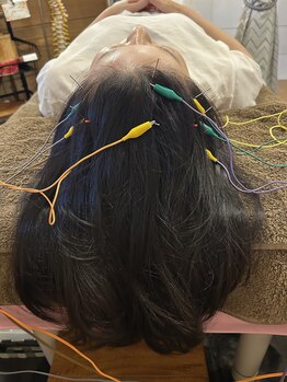 かすがい鍼灸院リハート(Re.heart)/不眠解消＆自律神経調整