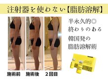 【レモンボトル6ｃｃ】ダイエットを頑張れない方へ！￥11000体験