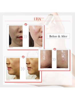 シエル(Ciel)/ララピール