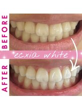 エクシアホワイト 倉吉店(ecxia white)/ビフォーアフター