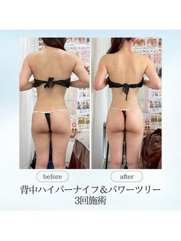 エスプレッソ(espresso,)/【約1ヶ月】でこんなに変わる♪