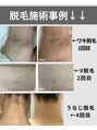 キュー(cue)&nbsp;他店では満足出来なかった方も光のレベルを調節し抜けを実感☆