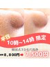 【平日10時～14時】夏前の毛穴ケアにオススメ◎韓国式３D毛穴洗浄8,800円→