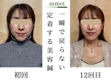 asmot鍼灸 整体院 代々木上原(asmot鍼灸 整体院)の雰囲気（【国家資格者】の小顔施術/美容鍼/代々木上原駅/リフトアップ）