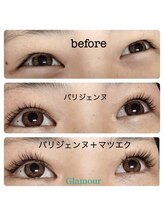 グラマー(Glamour)/パリエク　ビフォーアフター