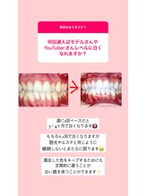 エクシア ホワイトニング 鶴岡店/ビフォーアフター