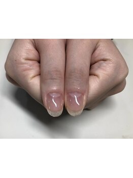 爪の悩みを解消できる（ケア含む）