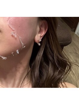 お肌をきれいにしたい