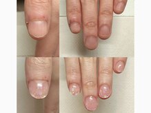 ムーディー(MOODY)の雰囲気(MOODYの深爪矯正は伸びても綺麗)