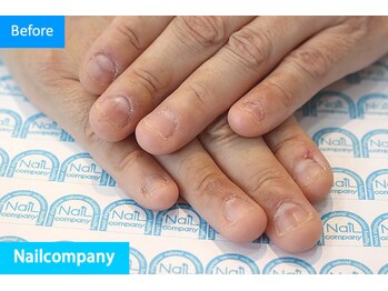 ネイルカンパニー/