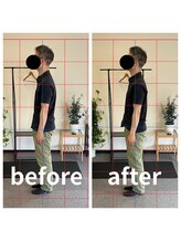 熊本カワル整体 JR上熊本駅院/巻き肩