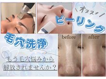 大人気！ピーリングメニューがあるサロン♪