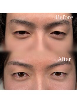 神戸のまゆげ屋さん 摂津本山 岡本店/【メンズ眉】眉毛WAX+間引き