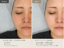 シロ(shiro)の雰囲気(ケアケア+美肌コース+リフトアップ)