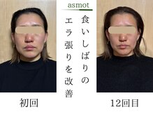 asmot鍼灸 整体院 代々木上原(asmot鍼灸 整体院)の雰囲気（美容鍼◎初回→3回目/代々木上原駅/美容鍼/整体/肩こり/腰痛）
