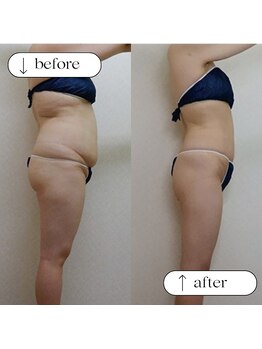 ユウキ(yuuki)/エンダモロジーアライアンス