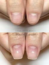 マリーロール 梅田店(Marie Laure)/深爪矯正/自爪育成/自爪風