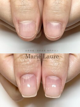 マリーロール 梅田店(Marie Laure)/深爪矯正/自爪育成/自爪風