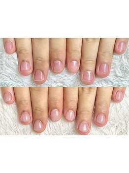 爪の悩みを解消できる（ケア含む）