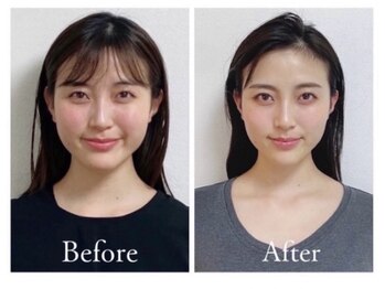 マナレア 湘南(Manalea)の写真/《大きさ・形・バランスまで美しく》あなた史上最高の小顔へ◎頭蓋骨・骨格・筋膜から整える本格小顔矯正