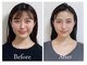 マナレア 湘南(Manalea)の写真/《大きさ・形・バランスまで美しく》あなた史上最高の小顔へ◎頭蓋骨・骨格・筋膜から整える本格小顔矯正