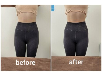 バニーヒップ(Bunny Hip)/before→after