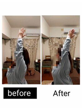 アース エンジェル整体院/ビフォアフ 肩こり ストレッチ