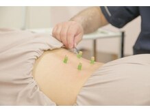 新越谷駅前鍼灸整骨院/灸で、免疫力アップ