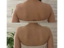エクラピュール(Eclatpur)の雰囲気（歪み、流れを整えて見た目だけじゃなく身体も軽くなります）