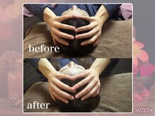 ネクシア 恵比寿(NEXIA EBISU)/頭のむくみスッキリ！小顔効果も