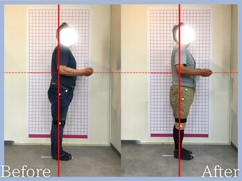 トロ整骨院(toro整骨院)/EMS24回★60代男性