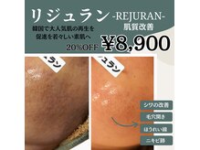 キレナル(KIRENAL)